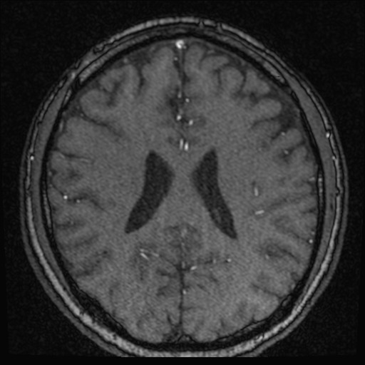 Click on the Serie image to view the images of VILLANUEVA, WILLIAM A.